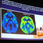 Il Cervello fragile degli adolescenti
